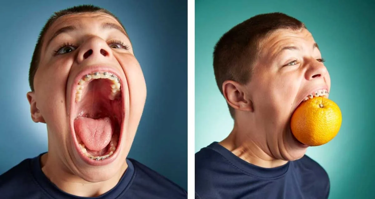 'বিশাল মুখগহ্ববর' নিয়ে গিনেস বুক অফ ওয়ার্ল্ড রেকর্ডে জায়গা করে নিল আইজ্যাক জনসন