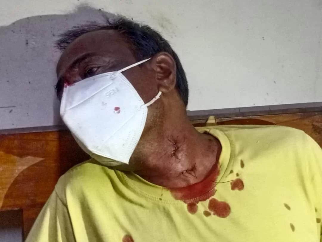 তৃণমূল কংগ্রেসের শ্রমিক সংগঠনের ব্লক সভাপতি কে খুনের চেষ্টার অভিযোগ বিজেপি কর্মীর বিরুদ্ধে