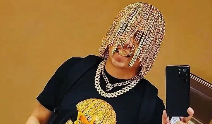 মাথায় সোনার চুল বসিয়ে সংবাদ শিরোনামে মেক্সিকান গায়ক