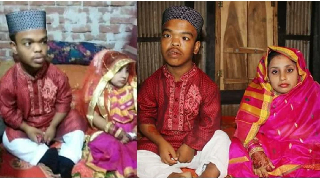 ৪৪ ইঞ্চি বরের ৩৩ ইঞ্চির কনে, কোথায় হল এই অভিনব বিয়ে? জানুন বিস্তারিত