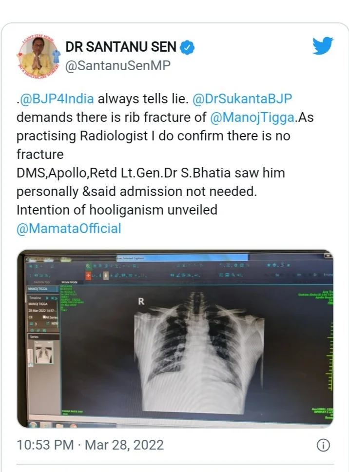 ব্যাকফুটে বিজেপিঃ আহত হননি দলীয় বিধায়করা, প্রমাণ দিয়ে দাবি মদন মিত্র - ডাঃ শান্তনু সেনের