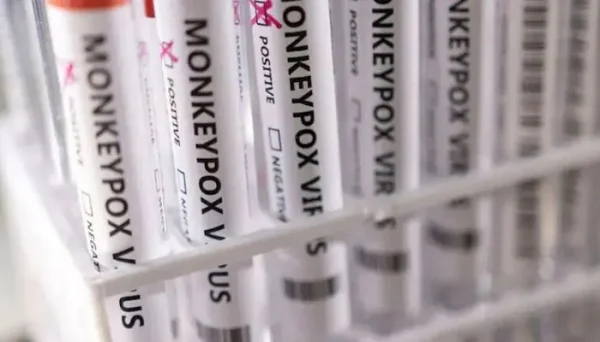 নতুন নাম পাবে মাঙ্কিপক্স