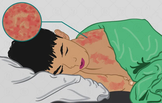 খোস্তা-২: করোনার মতো নয়া ভাইরাস মিলল রাশিয়ায়