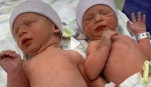 ৩০ বছরের হিমায়িত ভ্রূণ থেকে জন্ম যমজ শিশুর!