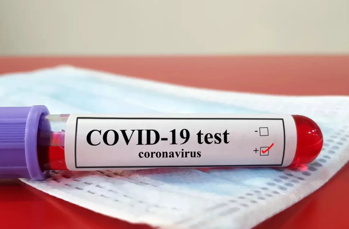 চিন সহ ৬টি দেশের যাত্রীদের নেগেটিভ কোভিড রিপোর্ট বাধ্যতামূলক, ১ জানুয়ারি থেকে কার্যকর কেন্দ্রের নয়া নিয়ম