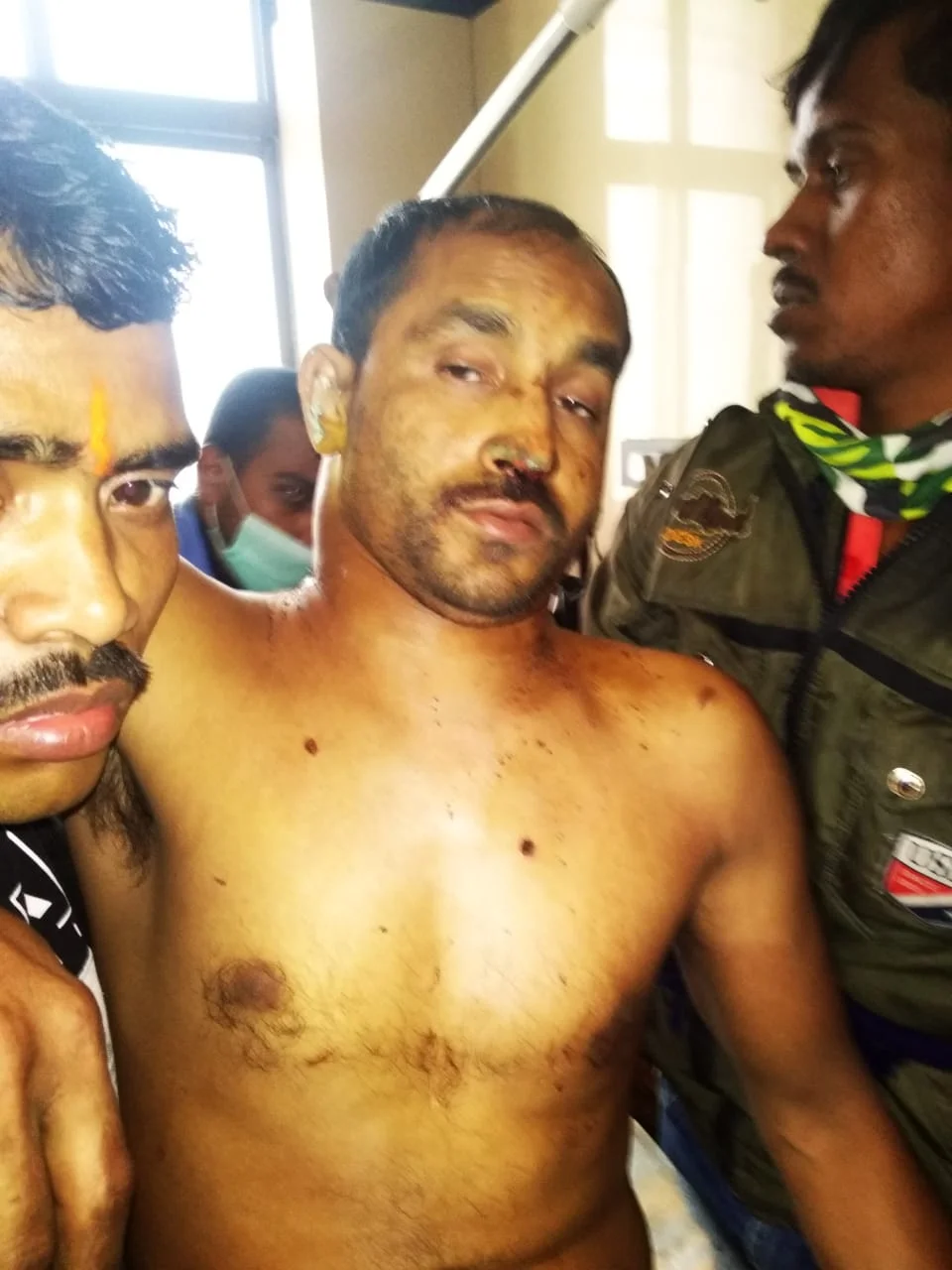 সুন্দরবনে বাঘের কামড়ে আহত  মৎস্যজীবির মৃত্যু কলকাতার হাসপাতালে   