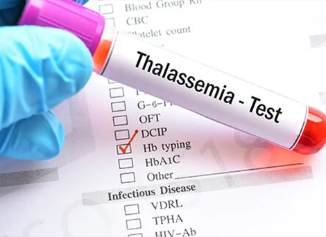 থ্যালাসেমিয়া, সিকেল সেল ডিজিস রুখতে বাধ্যতামূলক হল টেস্টের নমুনা সংগ্রহ