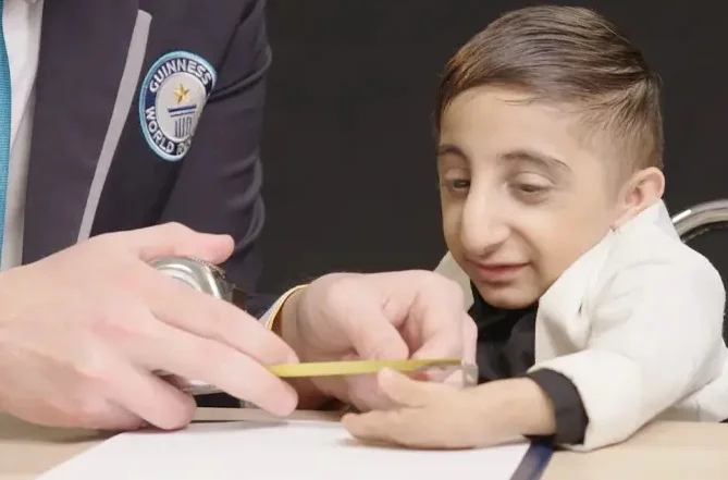 উচ্চতা ২ ফুট ১.৬ ইঞ্চি, ওজন ৬.৫ কিলোগ্রাম! বিশ্বের ক্ষুদ্রতম যুবক আফসিন গাদেরজাদেহ