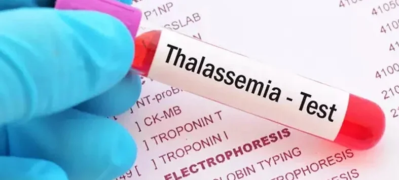 থ্যালাসেমিয়া নির্মূলে চিকিৎসকদের বিশেষ প্রশিক্ষণের ব্যবস্থা