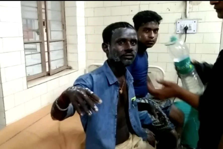 বৈদ্যুতিক হিটার থেকে আগুন লেগে অগ্নিদগ্ধ ৩ যুবক, হাসপাতালে ভর্তি