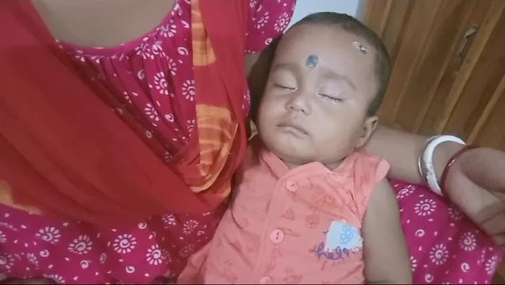 বিরলতম রোগে আক্রান্ত বালুরঘাটের শিশু