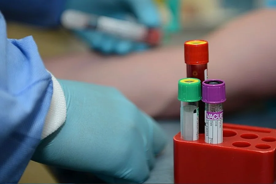 নতুন করে স্বাস্থ্যের অবনতি হয়নি আক্রান্তদের, নিপা আক্রান্তের খবর নেই