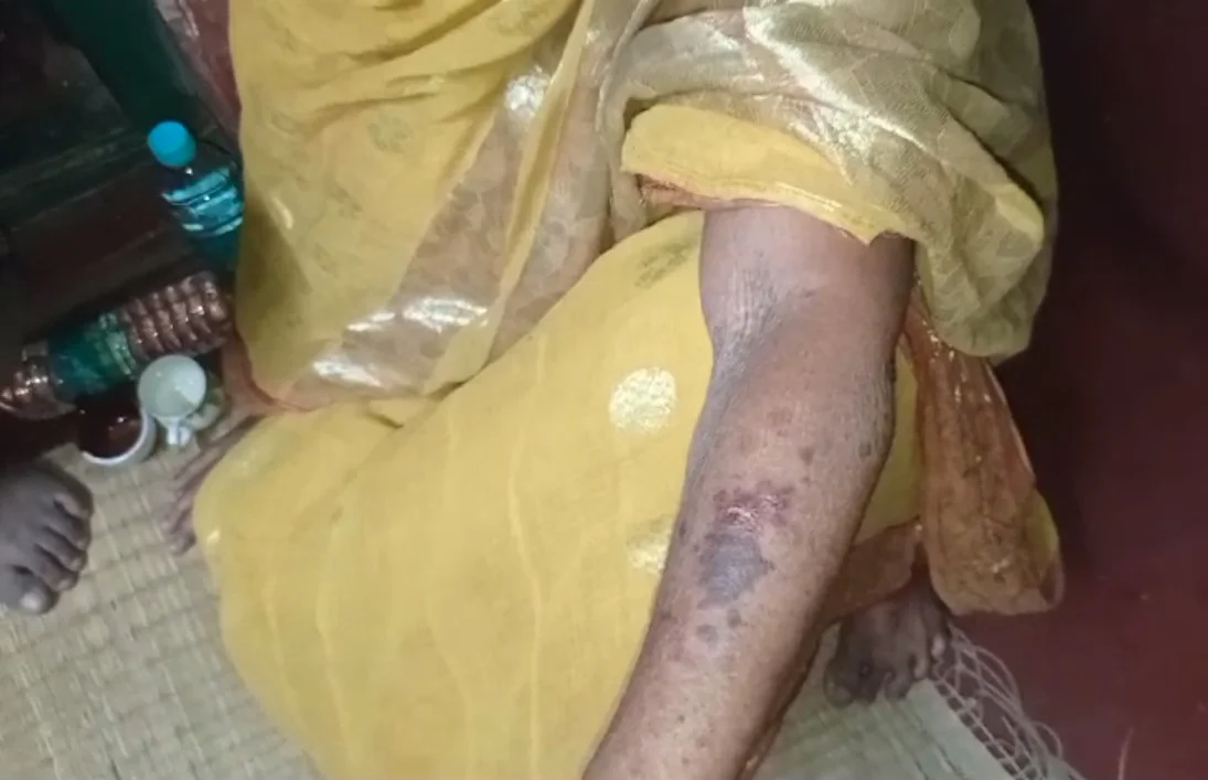 ডিভোর্সের পর কেন বিয়ে প্রাক্তন স্বামীর, হামলা প্রাক্তন স্ত্রী সহ তাঁর পরিবারের