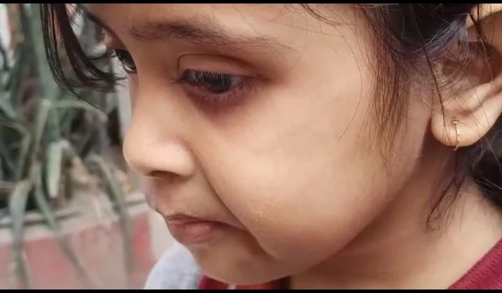 হাওড়া: ক্লাসে দুষ্টুমি, ছাত্রীকে থাপ্পড় শিক্ষিকার, গালে পাঁচ আঙুলের দাগ