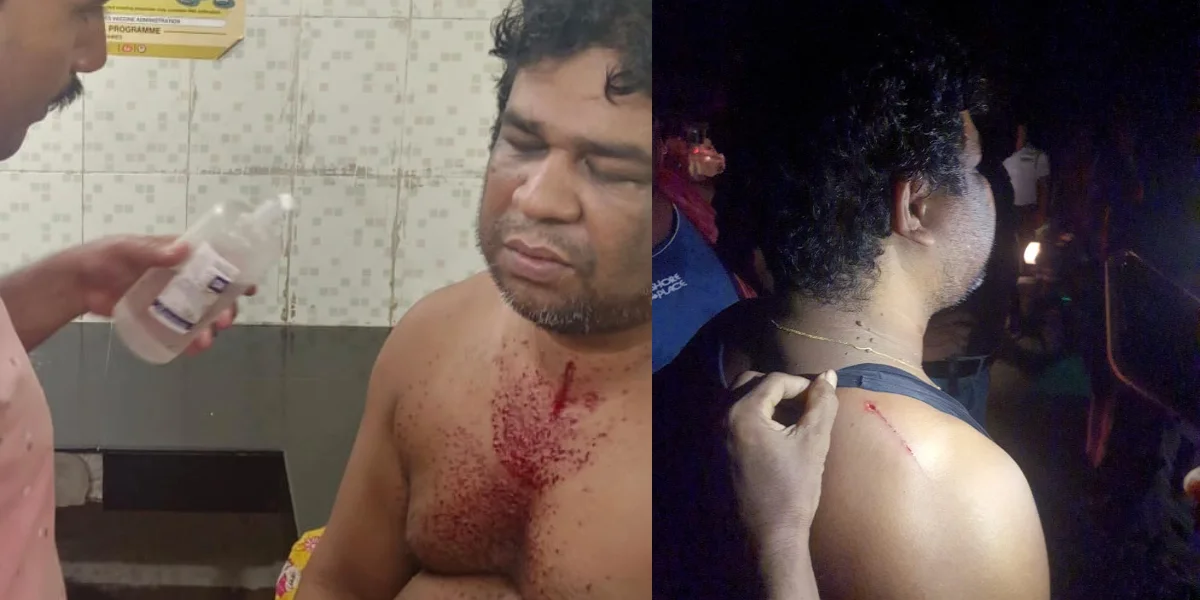 জয়নগরে তৃণমূলের পঞ্চায়েত সদস্যকে খুনের চেষ্টা, অভিযোগ বিজেপির দিকে