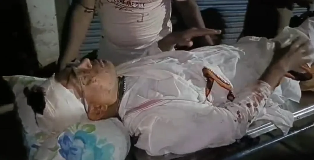 দলীয় বৈঠক ছেড়ে বাড়ি ফেরার পথে দুষ্কৃতিদের হাতে আক্রান্ত ক্যানিংয়ের পঞ্চায়েতের তৃণমূল সদস্য