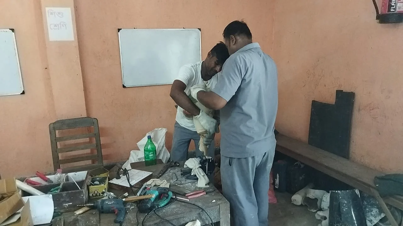 বহড়ুতে হয়ে গেল কৃত্রিম অঙ্গ প্রতিস্থাপন শিবির