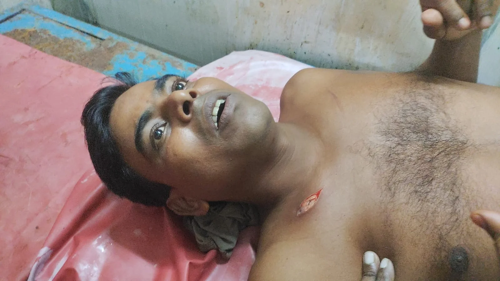 বুকে চাকুর আঘাত!প্রাণে বাঁচতে কল্যাণী সীমান্ত থেকে পালিয়ে এলেন ক্যানিংয়ের যুবক