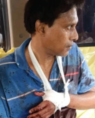 গড়িয়ায় বিজেপি কর্মীকে কাটারির কোপ, ধৃত তৃণমূল কর্মী