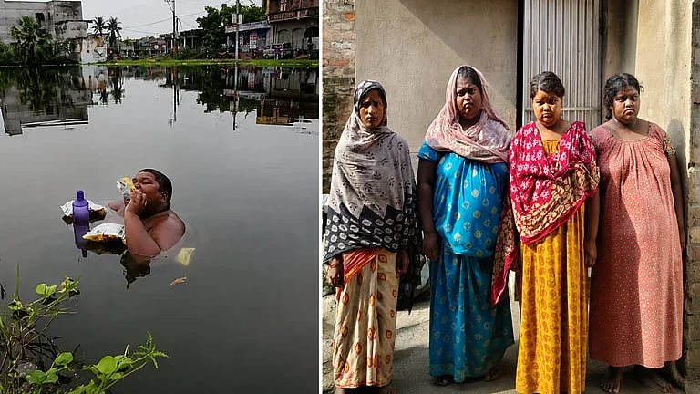 ইকবালের পর এবার তিন বোনও আক্রান্ত বিরল রোগে, বাঁচার আশায় প্রহর গুনছে পরিবার