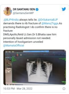 ব্যাকফুটে বিজেপিঃ আহত হননি দলীয় বিধায়করা, প্রমাণ দিয়ে দাবি মদন মিত্র - ডাঃ শান্তনু সেনের
