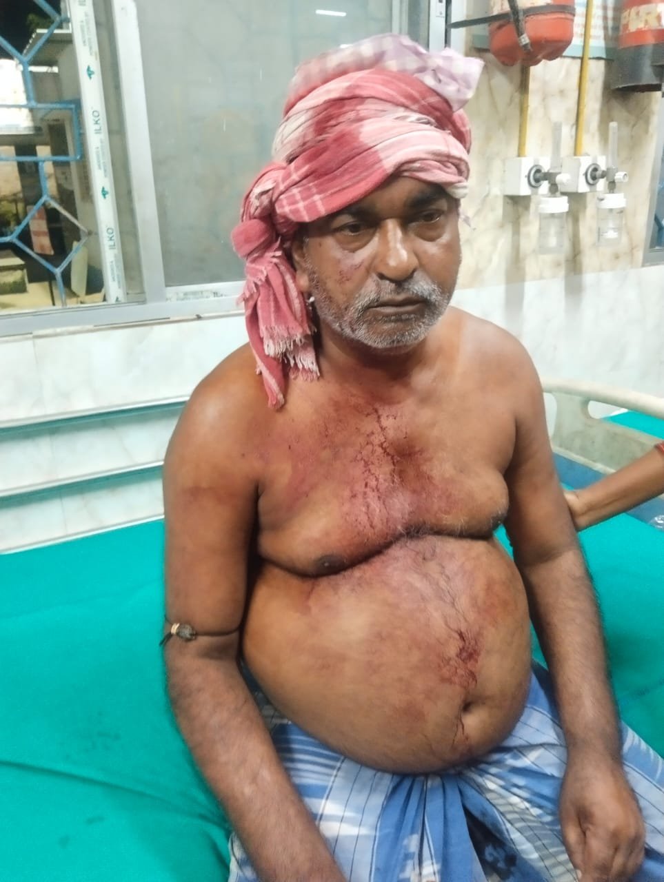 তৃণমূলের বুথ সভাপতিকে বন্দুকের বাঁট দিয়ে মারধর করার অভিযোগ আইএসএফ এর বিরুদ্ধে